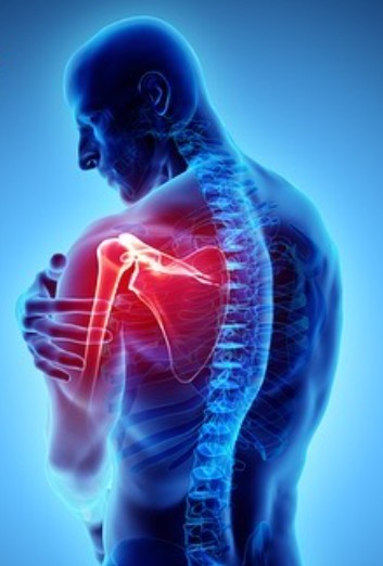 Read more about the article Shpatulla e ngrirë (Frozen shoulder)